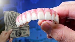 Full Mouth Dental Implants. Cost and Comparison