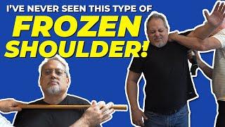 ️ FROZEN SHOULDER COMPLETELY LOCKED UP!! 