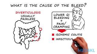 Lower GI Bleeding: The 3 steps to take when you aren't sure of the source