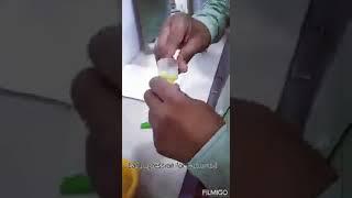 Ear Impression for earmould, hearing aid fitting in Muzaffarpur Aud. Himanshu 8447353649