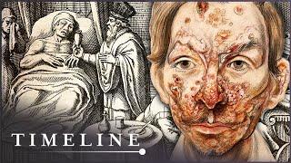 The True Terrors Of Tudor Medicine | Hidden Killers | Timeline