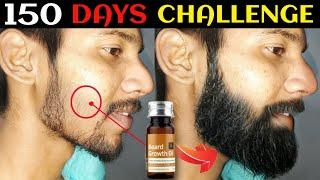 Ustraa Beard Growth Oil After 150 Days Review | Best Beard Oil For Patchy Beard in India 2024 !