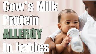 Cow’s Milk Protein Allergy: Symptoms and Treatment