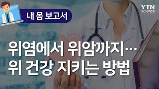 [내 몸 보고서] 위염에서 위암까지…위 건강 지키는 방법  / YTN 사이언스