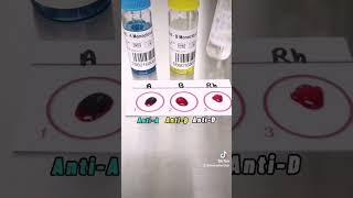 Blood typing Or Blood grouping step by step #laboratory #medtech #medtechstudent #mls #mt #bloodbank