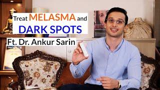 How to treat melasma, hyperpigmentation, & dark spots | Dr. Ankur Sarin ft. Fixderma