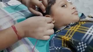 Auditory Brainstem Response,BERA in Sri Ganganagar, 8447353649 Aud. Himanshu K Sanju, M.Aud (AIISH)