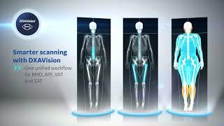 DXA Products for Bone & Metabolic Health