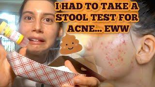 I HAD TO TAKE A STOOL TEST FOR MY ACNE and GUT HEALTH!?!?  MY REACTION, THE PROCESS AND EXPERIENCE..