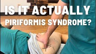 Is it actually piriformis syndrome? Here’s how an adhesion release methods specialist can tell