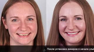 Отзыв Стасевич Александры об Orlovsky Dental Center Правобережье /г.Калуга