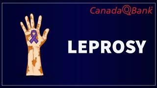 Leprosy