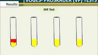 MR-VP Test