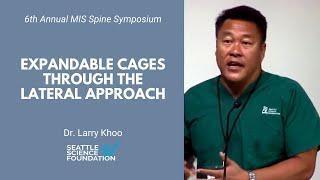 Expandable Cages Through a Lateral Approach - Larry Khoo, MD