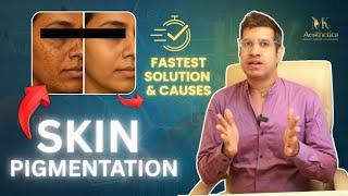 Skin Pigmentation Secrets REVEALED! by Dermatologist