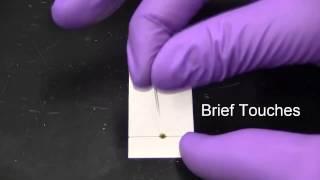 Thin Layer Chromatography