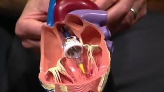 Heart Catheterization