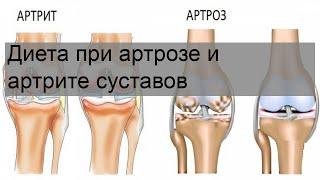 Диета при артрозе и артрите суставов