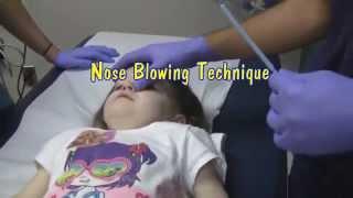 Nasal Foreign Body Removal Techniques