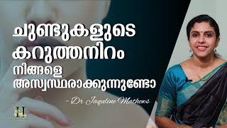 Lip pigmentation | ചുണ്ടുകളുടെ കറുത്ത നിറം | Natural remedies | Dr Jaquline Mathews BAMS