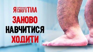 Потерял способность самостоятельно передвигаться – Я соромлюсь свого тіла | ДОКАЗАТЕЛЬНАЯ МЕДИЦИНА