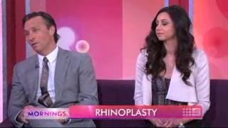 Dr William Mooney "Rhinoplasty Reveal Real Patient"