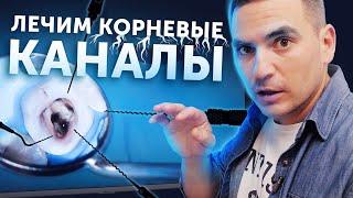 Лечение корневых каналов зуба | Процедура под микроскопом