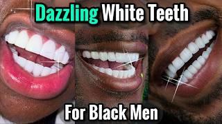 How to Get a Dazzling White Smile for Black Men