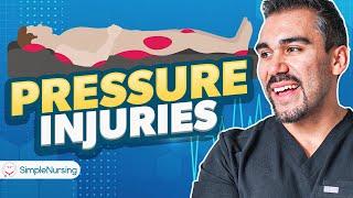 Pressure Injuries (Ulcers) Nursing | Patho, Causes, 6 Stages, Braden Scale