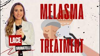 How to treat Melasma - Laser