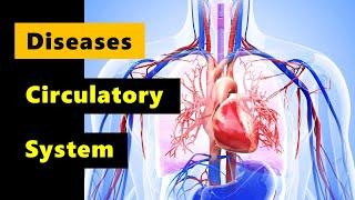 Diseases of the Circulatory System  I  Grade 9 - Q1 l PART 2