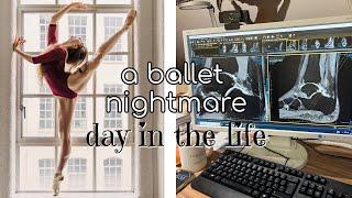 a ballet nightmare - why i need surgery