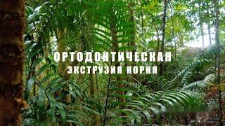 ОРТОДОНТИЧЕСКАЯ ЭКСТРУЗИЯ КОРНЯ ЗУБА