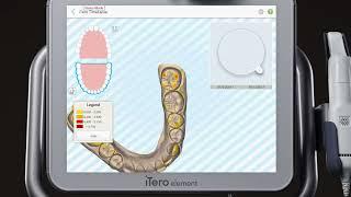 iTero® Scanner Tutorial: Using Demo Mode