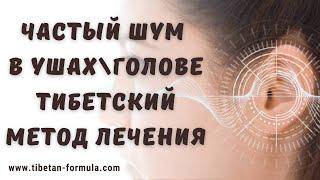 Частый шум в ушах\голове: Тибетский метод лечения