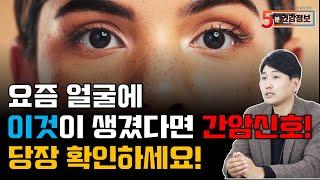 요즘에 얼굴에 이것이 생겼다면 간암 신호! 당장 확인하세요!