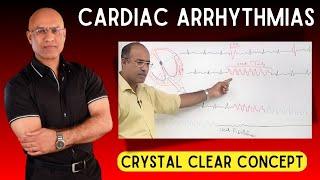 Cardiac Arrhythmias | Tachycardia and Bradycardia | Cardiology