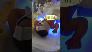 Blue Light Therapy (Day 2) #day2 #lucy #viralvideo #shorts