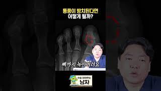 통풍이 방치된다면 어떻게 될까? #통풍 #올바른서울병원 #shorts