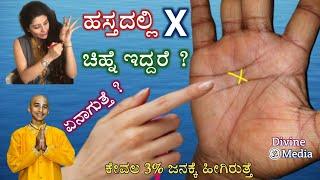 ನಿಮ್ಮ ಕೈನಲ್ಲಿ X ಗುರುತು ಇದ್ದರೆ ಏನರ್ಥ ಗೊತ್ತಾ ? ಹಸ್ತ ಸಾಮುದ್ರಿಕ ಶಾಸ್ತ್ರದ ಪ್ರಕಾರ ನಿಮ್ಮ ಜೀವನದ ಸತ್ಯ Palm