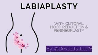 VAGINAL REJUVENATION by @DrScottsdale⁣ Labiaplasty, Perineoplasty and Clitoral Hood Reduction