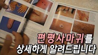 편평사마귀를상세하게알려드립니다