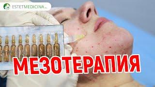 Мезотерапия для лица    КАК ПРОВОДИТСЯ, БОЛЬНО ЛИ? Mesotherapy. Мезотерапия для области глаз, шеи