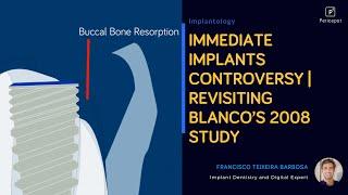 Immediate Implants Controversy | Revisiting Blanco’s 2008 Study