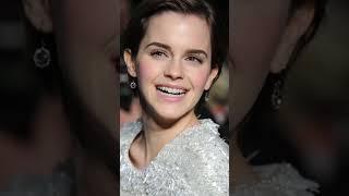 "Unleashing Emma Watson: Exploring the Multi-faceted Talents and Charitable Works of a Modern Icon"