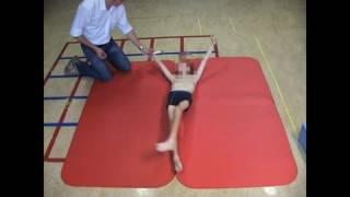 Dyskinetic cerebral palsy, case 3