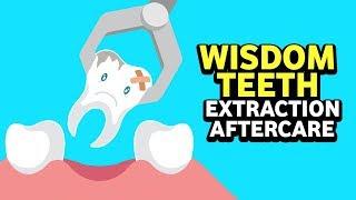 Wisdom Teeth Extraction Aftercare by Dr. sandesh mayekar | Wisdom Teeth | Teeth Healthcare