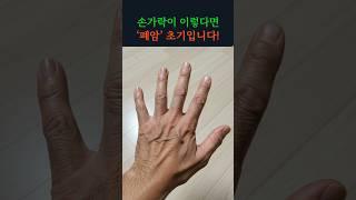 손가락 모양이 이렇다면, 폐암의 신호일 수 있습니다!