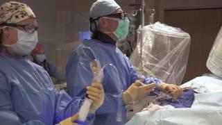 What is a Cardiac Cath Lab? Dr. John Pap, UP Health System - Marquette