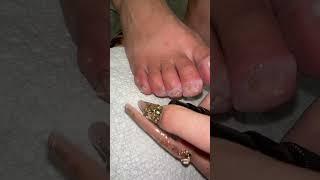 Raina’s toe nails update